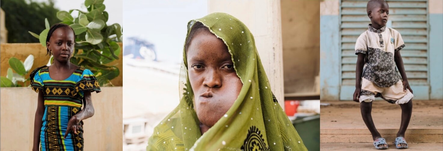 mercy ships people mercy ships people